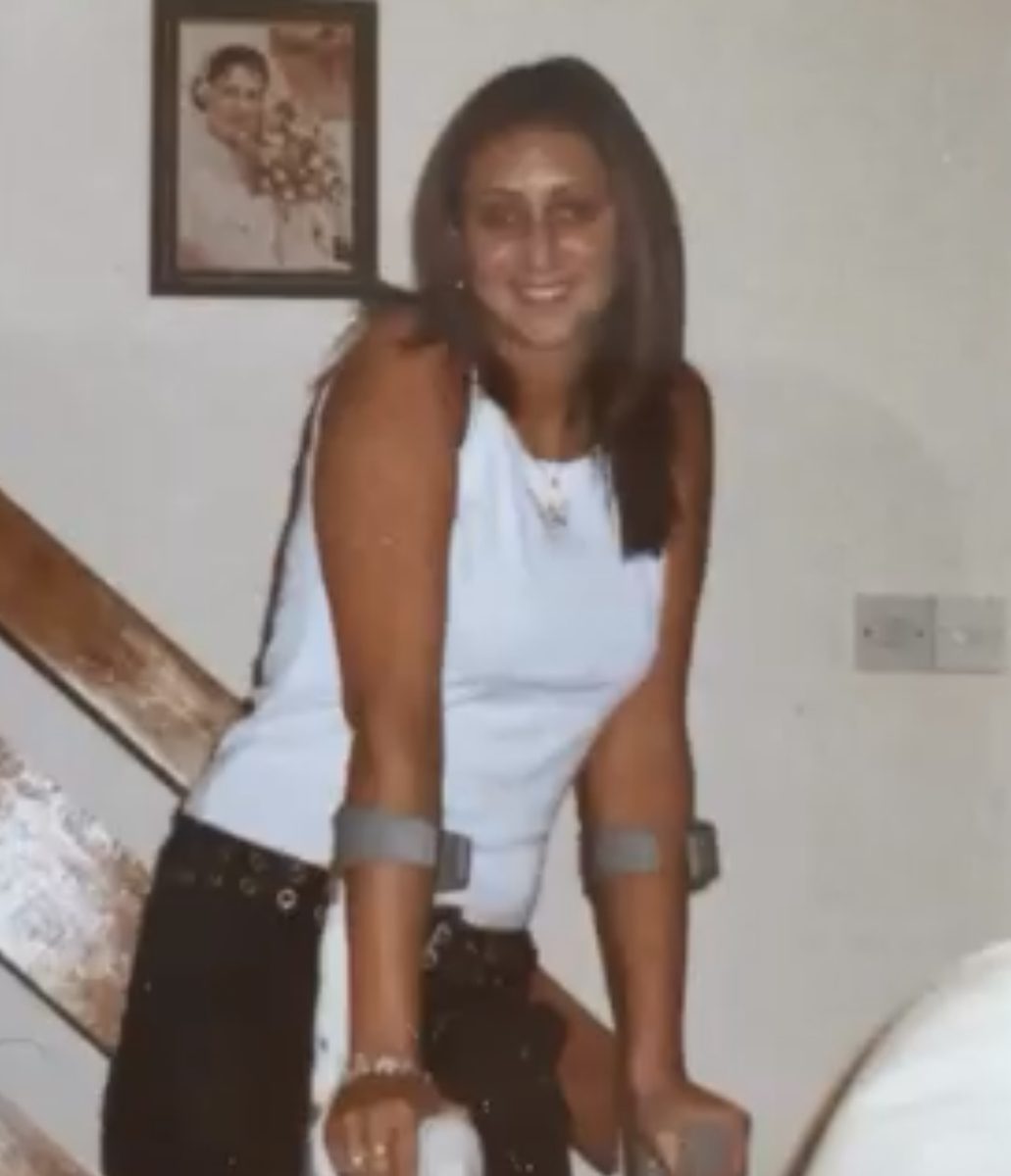 By eighteen I was wheelchair bound and lost the sight in my right eye. (I never let anyone take photos of me at my worst back then, so this was me on the road to recovery.)